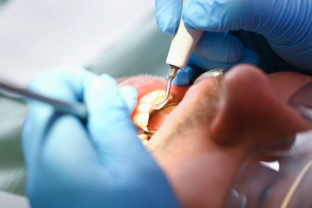 Best Weekend Emergency Dentist in Lisle, IL
