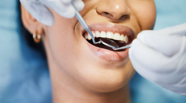 Best Emergency Root Canal Treatment in Lisle, IL