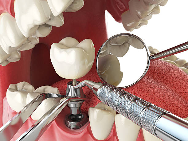 Best Emergency Dental Services for Seniors in Lisle, IL